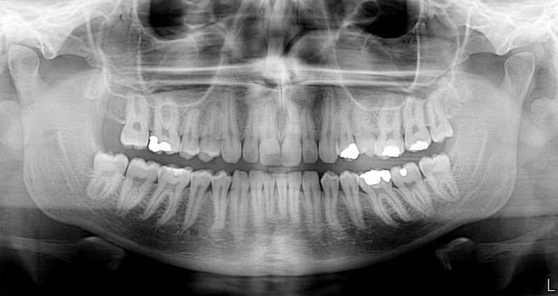 panoramic-xray-king-square-dental-practice